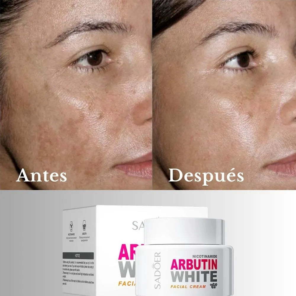 LA CREMA ANTIMANCHAS # 1 ORIGINAL 😍 Aclara, Hidrata y Rejuvenece