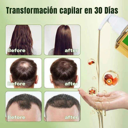 Shampoo de Batana con Extracto de Romero ORIGINAL 💥OFERTA BLACK DAY