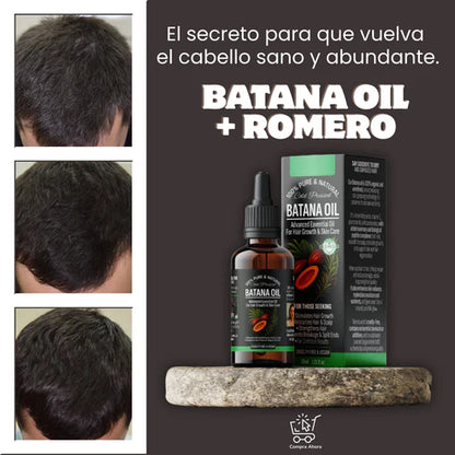 Aceite de Batana + Romero ORIGINAL OFERTA ESPECIAL BLACK DAY 🤩