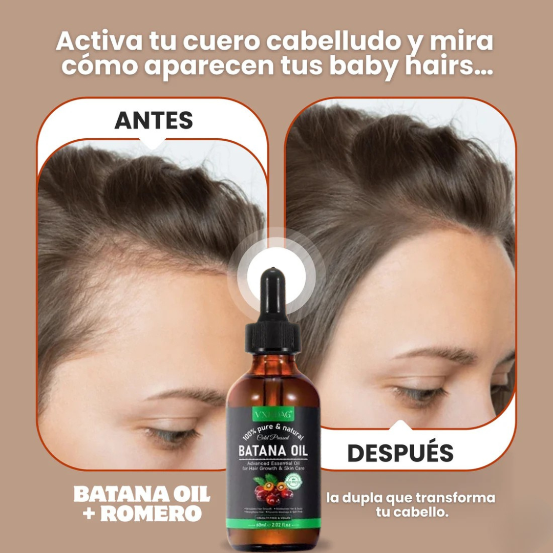 Aceite de Batana + Romero ORIGINAL OFERTA ESPECIAL BLACK DAY 🤩
